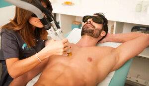 Epilation laser definitive réalisée sur un homme par une esthéticienne Maelis