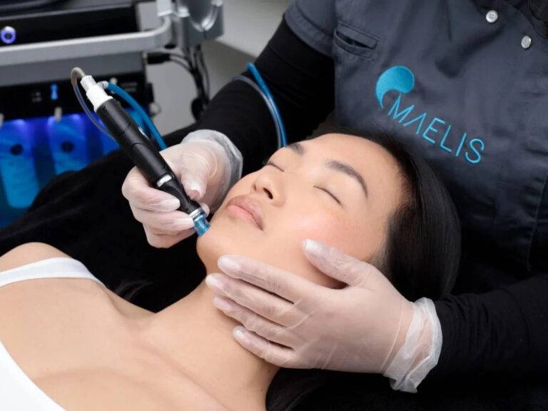 Séance d'Hydrafacial réalisée sur femme